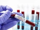 Personale del Covid non stabilizzato, Canalis: &quot;Pasticcio dell'assessorato alla Sanità&quot;