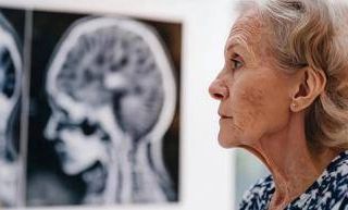 Giornata salute donne, Sin 'prendetevi cura anche della salute neurologica'