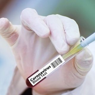 Nuova organizzazione nell’Asl Novara per vaccini anticovid e tamponi