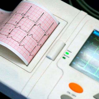 Al Maggiore della Carità aperto il nuovo ambulatorio per le cardiomiopatie rare