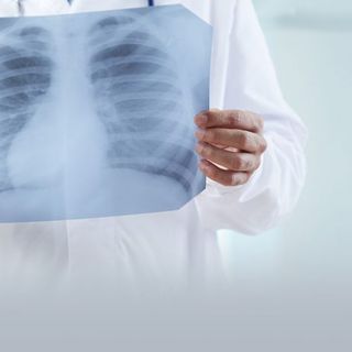 Accesso diretto per le prestazioni di radiologia nella ASL NO: orari e sedi