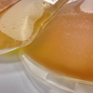 Interventi con il plasma iperimmune all’Aou: una decina i pazienti Covid curati positivamente