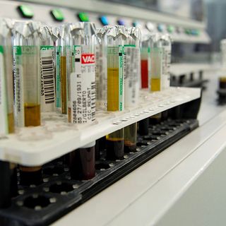 In Piemonte diversi i ser.d che hanno avviato screening per l’Epatite C