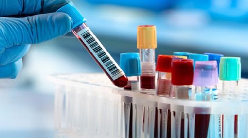 Arona, il centro prelievi chiuso per la festa patronale Arona, il centro prelievi chiuso per la festa patronale