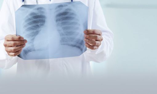 Accesso diretto per le prestazioni di radiologia nella ASL NO: orari e sedi