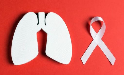 Trecate in prima linea contro il cancro al polmone Trecate in prima linea contro il cancro al polmone