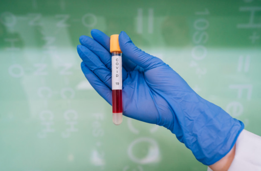 Sono 2287 i positivi in più rispetto a ieri, il 45% è asintomatico