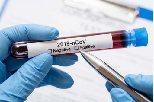 Ventidue letti per pazienti Covid a Veruno Ventidue letti per pazienti Covid a Veruno