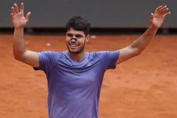 Internazionali, Alcaraz e il cerotto al naso: cos'è e a cosa serve