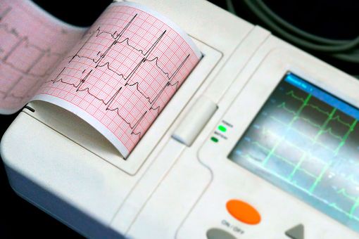 Al Maggiore della Carità aperto il nuovo ambulatorio per le cardiomiopatie rare Al Maggiore della Carità aperto il nuovo ambulatorio per le cardiomiopatie rare