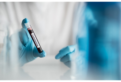 Oltre 100 pazienti dimessi dai reparti Covid e 667 nuovi casi positivi Oltre 100 pazienti dimessi dai reparti Covid e 667 nuovi casi positivi