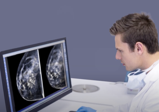 Prevenzione Serena: screening mammografico gratuito per le donne in Piemonte Prevenzione Serena: screening mammografico gratuito per le donne in Piemonte