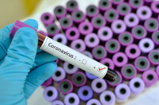 Covid-19, cambiano le regole della raccolta rifiuti per i positivi e per chi è in quarantena