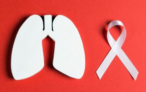 Trecate in prima linea contro il cancro al polmone