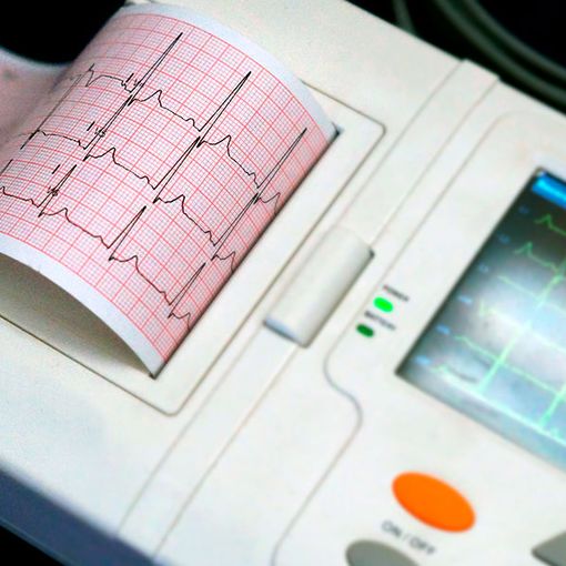 Al Maggiore della Carità aperto il nuovo ambulatorio per le cardiomiopatie rare