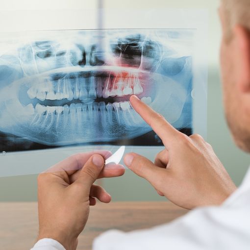 Si prolungano i lavori presso la sede di Radiologia di Arona: sospese ancora le attività relative agli esami di ortopantomografia
