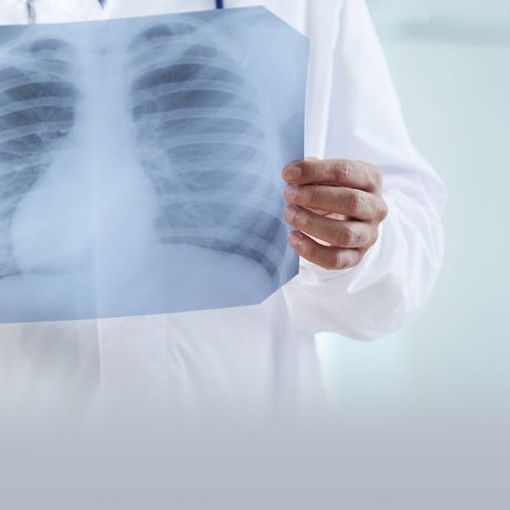 Accesso diretto per le prestazioni di radiologia nella ASL NO: orari e sedi