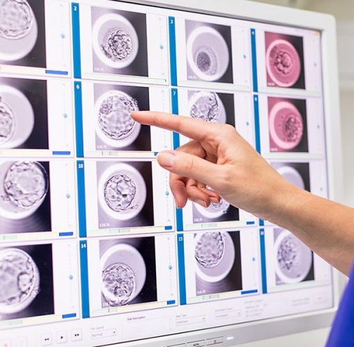Tecnologia all'avanguardia per la fecondazione assistita: Novara introduce l'embryoscope