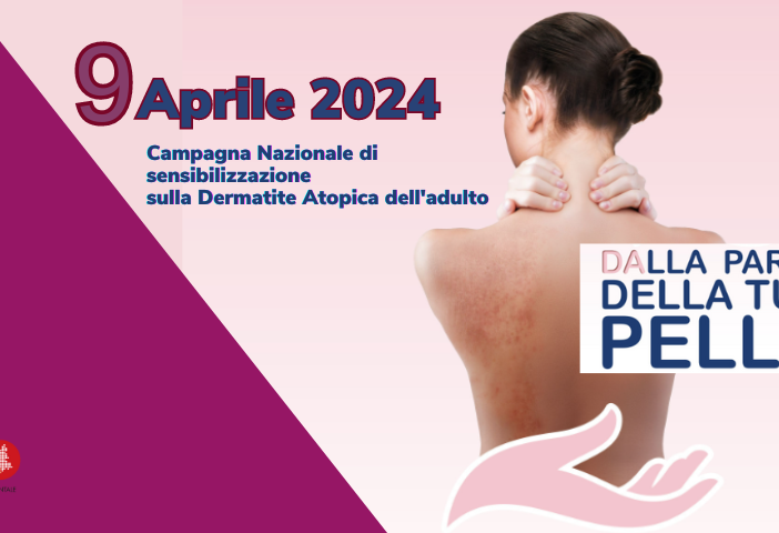 Giornata di sensibilizzazione sulla Dermatite Atopica: visite gratuite presso l'AOU di Novara