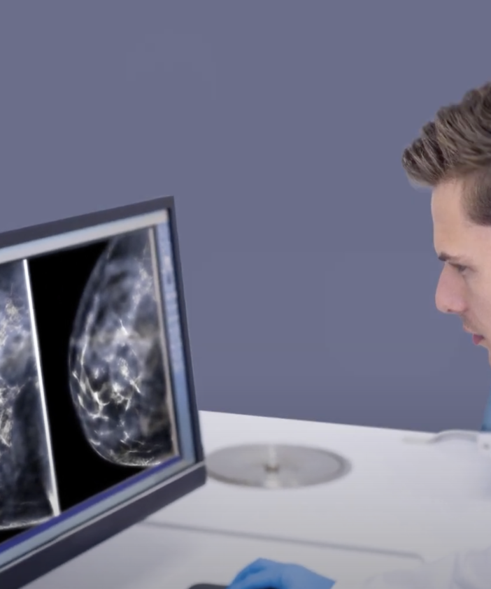 Prevenzione Serena: screening mammografico gratuito per le donne in Piemonte