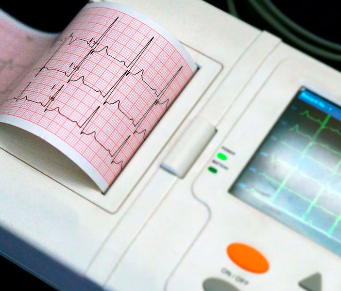 Al Maggiore della Carità aperto il nuovo ambulatorio per le cardiomiopatie rare