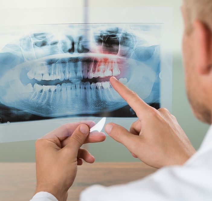 Si prolungano i lavori presso la sede di Radiologia di Arona: sospese ancora le attività relative agli esami di ortopantomografia