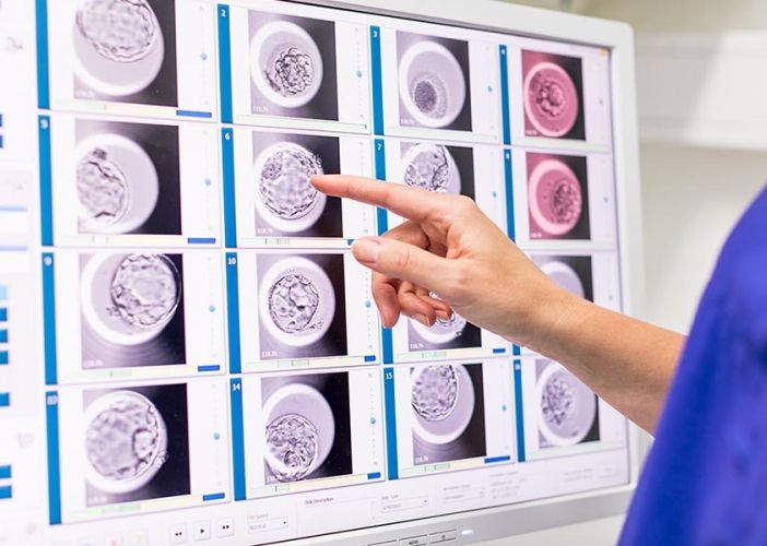 Tecnologia all'avanguardia per la fecondazione assistita: Novara introduce l'embryoscope