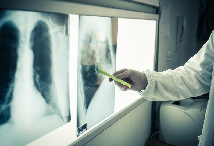 Lotta ai tumori dopo il Covid: &quot;La gente deve ricominciare a fare screening, ma servono anche specialisti&quot; VIDEO