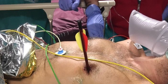 Notizie dal Piemonte. Arriva in ospedale con una freccia piantata nel cuore: salvato alle Molinette con un intervento senza precedenti Notizie dal Piemonte. Arriva in ospedale con una freccia piantata nel cuore: salvato alle Molinette con un intervento senza precedenti