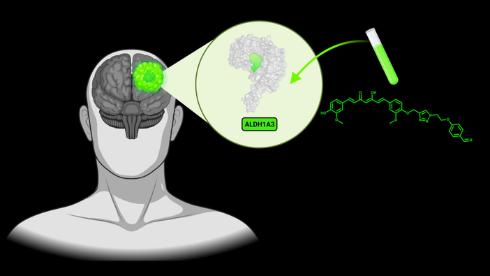 Dall’Upo nasce una tecnologia che “illumina” le cellule tumorali nel cervello Dall’Upo nasce una tecnologia che “illumina” le cellule tumorali nel cervello