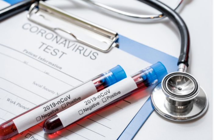 Coronavirus, Rossi e Salizzoni (Pd): piu’ tamponi in Piemonte Coronavirus, Rossi e Salizzoni (Pd): piu’ tamponi in Piemonte