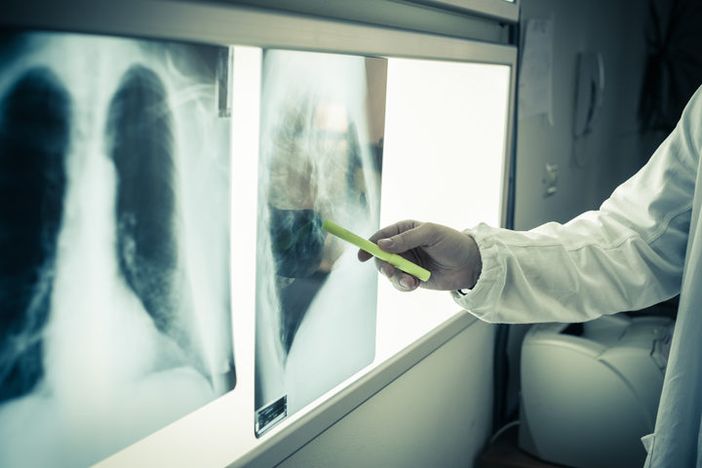 Lotta ai tumori dopo il Covid: &quot;La gente deve ricominciare a fare screening, ma servono anche specialisti&quot; VIDEO