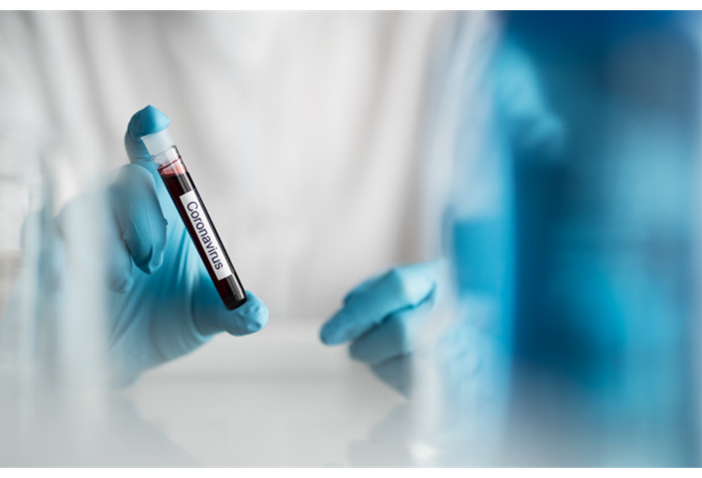 Oltre 100 pazienti dimessi dai reparti Covid e 667 nuovi casi positivi