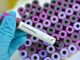 L' azienda galliatese A.D. Compound contro il Coronavirus