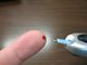 Prosegue lo screening gratuito contro il virus dell’Epatite C