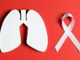 Trecate in prima linea contro il cancro al polmone