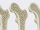 Ad Arona lo screening gratuito contro l’osteoporosi