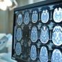 Giornata mondiale dell'Alzheimer, neurologi: &quot;Ora percorsi cura più efficaci e sostenibili&quot;