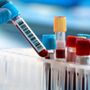 Aou Maggiore, nuovi sistemi informatici: chiusure temporanee dei laboratori analisi