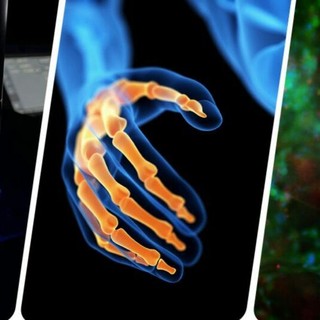 Flamin-Go: la ricerca che diventa cura