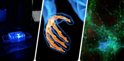 Flamin-Go: la ricerca che diventa cura