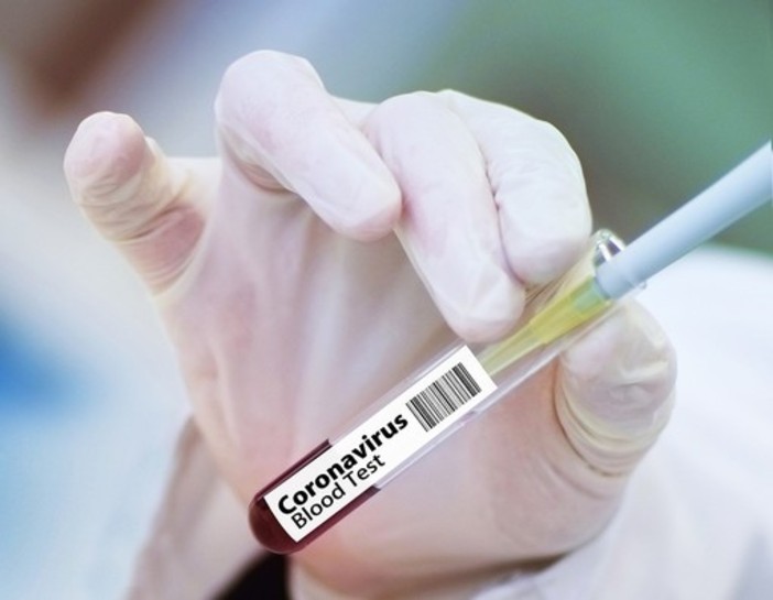 Nuova organizzazione nell’Asl Novara per vaccini anticovid e tamponi Nuova organizzazione nell’Asl Novara per vaccini anticovid e tamponi
