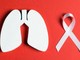Trecate in prima linea contro il cancro al polmone Trecate in prima linea contro il cancro al polmone
