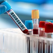 Novara, donatore di sangue positivo al virus West Nile: primo caso della stagione