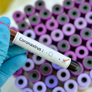 Tre persone contagiate dal Coronavirus a Novara