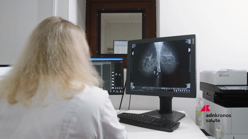 Tumori: a Milano il punto su test genomici e percorsi di cura nel carcinoma mammario Tumori: a Milano il punto su test genomici e percorsi di cura nel carcinoma mammario
