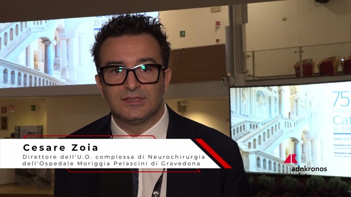 Tumori base cranica, neurochirurgo Zoia: "L'endoscopia è ormai diventata il gold standard"