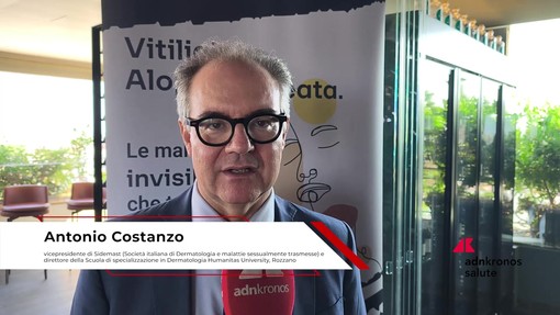 Farmaci: Costanzo (Sidemast), 'attendiamo ok Aifa per nuova cura per vitiligine e alopecia' Farmaci: Costanzo (Sidemast), 'attendiamo ok Aifa per nuova cura per vitiligine e alopecia'