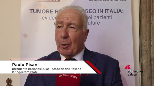 Tumore rinofaringeo, Pisani (Ailar): "Paziente ha diritto a cure multidisciplinari"
