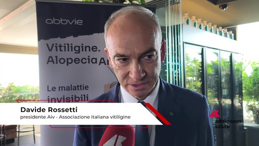 Salute: Rossetti (Aiv), 'associazione per accelerare riconoscimento nuove terapie vitiligine' Salute: Rossetti (Aiv), 'associazione per accelerare riconoscimento nuove terapie vitiligine'